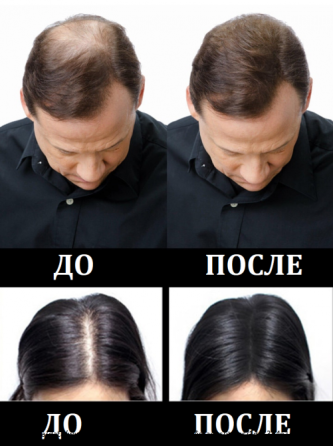 Загуститель для волос. Доставка по России Moscow