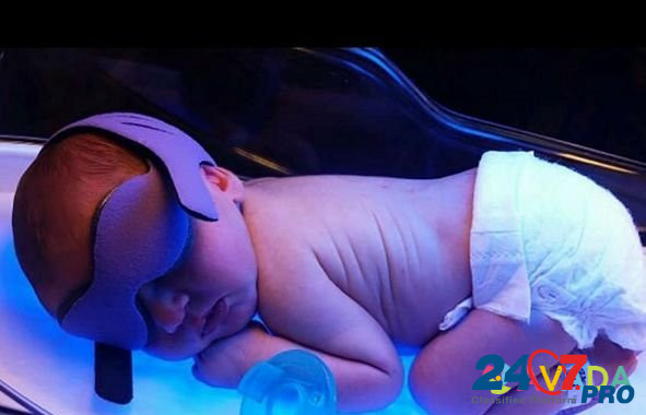 Желтушка новорожденных фотолампа Саратов - изображение 1