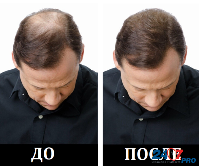 Мгновенный загуститель волос. Доставка по России. Москва - изображение 1